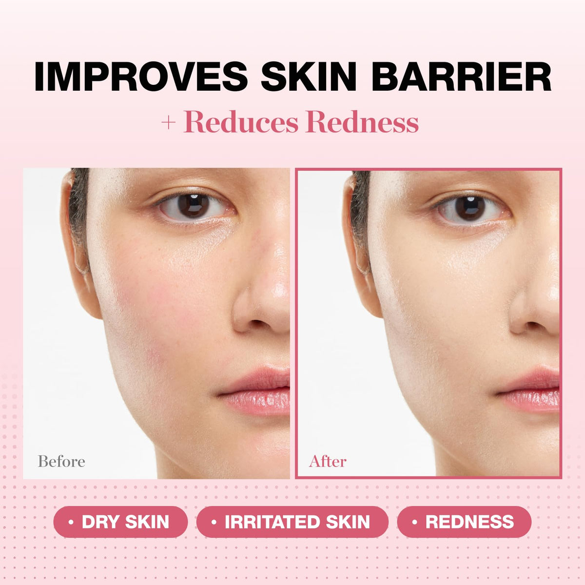 PHYSIOGEL close-up texture demonstrating smooth, hydrating barrier support