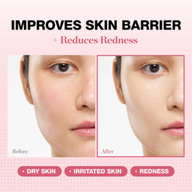 PHYSIOGEL close-up texture demonstrating smooth, hydrating barrier support