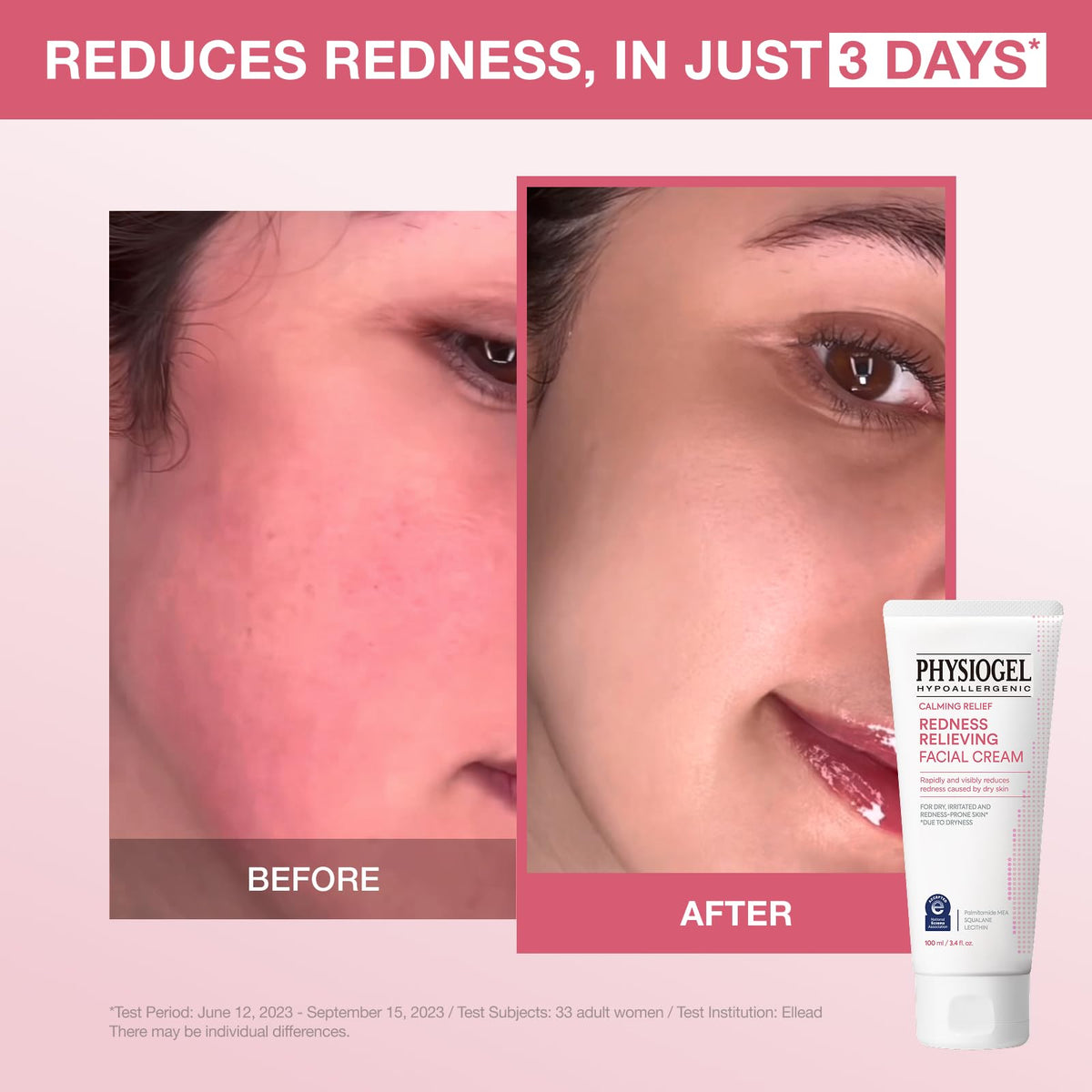 PHYSIOGEL cream texture close-up showing smooth, moisturizing finish