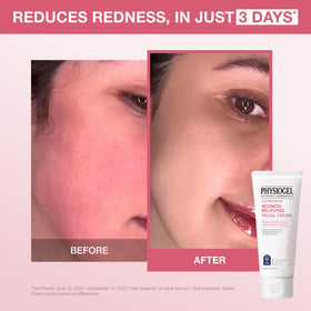 PHYSIOGEL cream texture close-up showing smooth, moisturizing finish