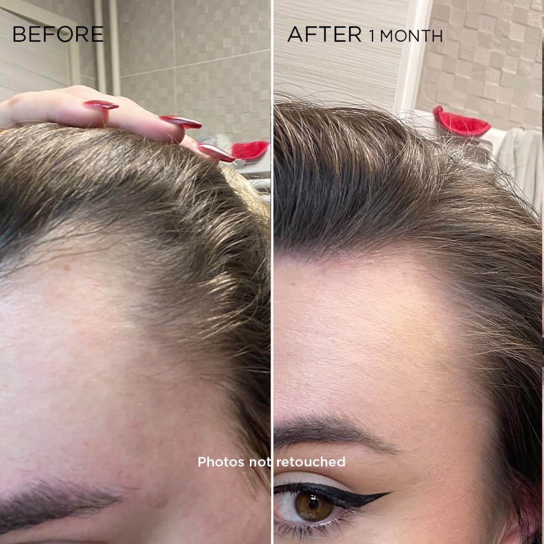 PHYTO serum texture close-up highlighting lightweight non-greasy finish