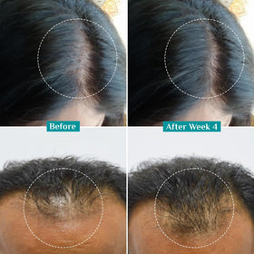 Pilgrim applying serum to scalp, supports targeted follicle nourishment benefit