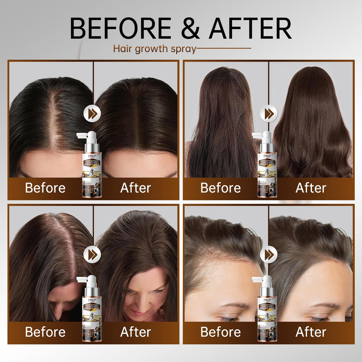 Person applying PKU spray to scalp illustrating easy targeted use for thinning areas