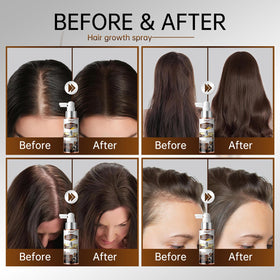 Person applying PKU spray to scalp illustrating easy targeted use for thinning areas