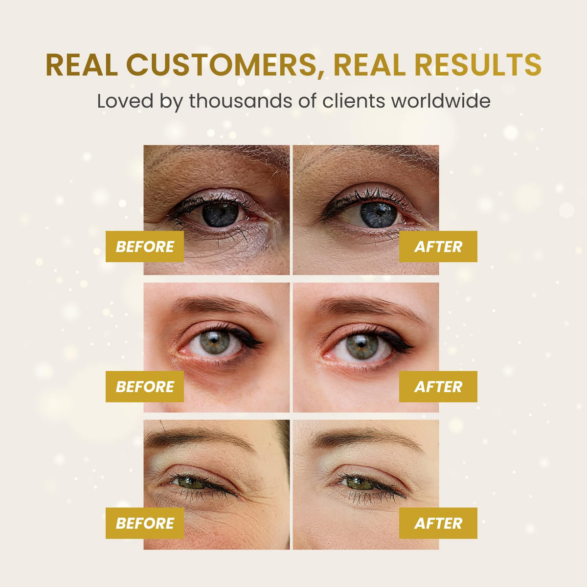 PLANTIFIQUE patch applied under-eye on model reduces puffiness visually
