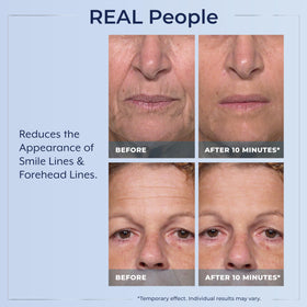 Plexaderm applied under-eye in demo to show instant tightening benefit