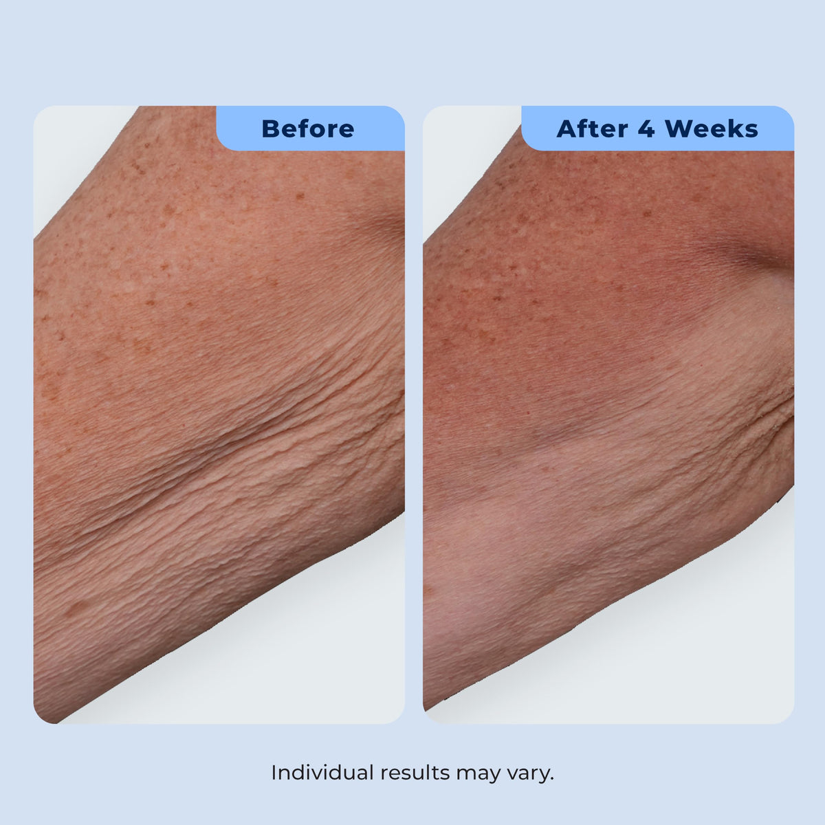 Plexaderm bakuchiol plant image highlighting soothing support benefit