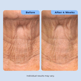 Plexaderm hyaluronic droplet close-up showing hydration boost benefit