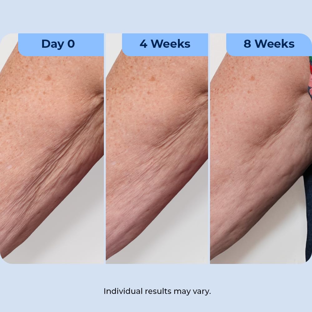 Plexaderm retinol ingredient visual emphasizing renewal benefit