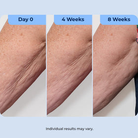 Plexaderm retinol ingredient visual emphasizing renewal benefit