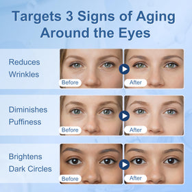 PLGOIE applying serum under eye to reduce puffiness and lines