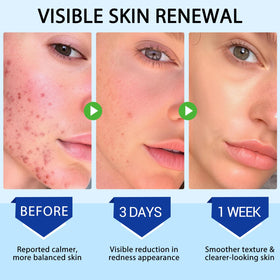 plomala applied to scalp showing targeted folliculitis care and reduced irritation