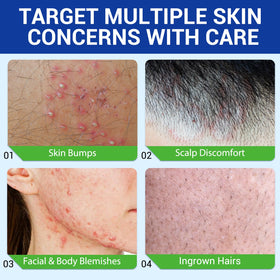plomala ingredient label highlighting salicylic acid and herbal extracts for clarity