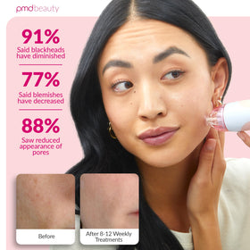 PMD Beauty device held in hand to demonstrate size and portability benefit
