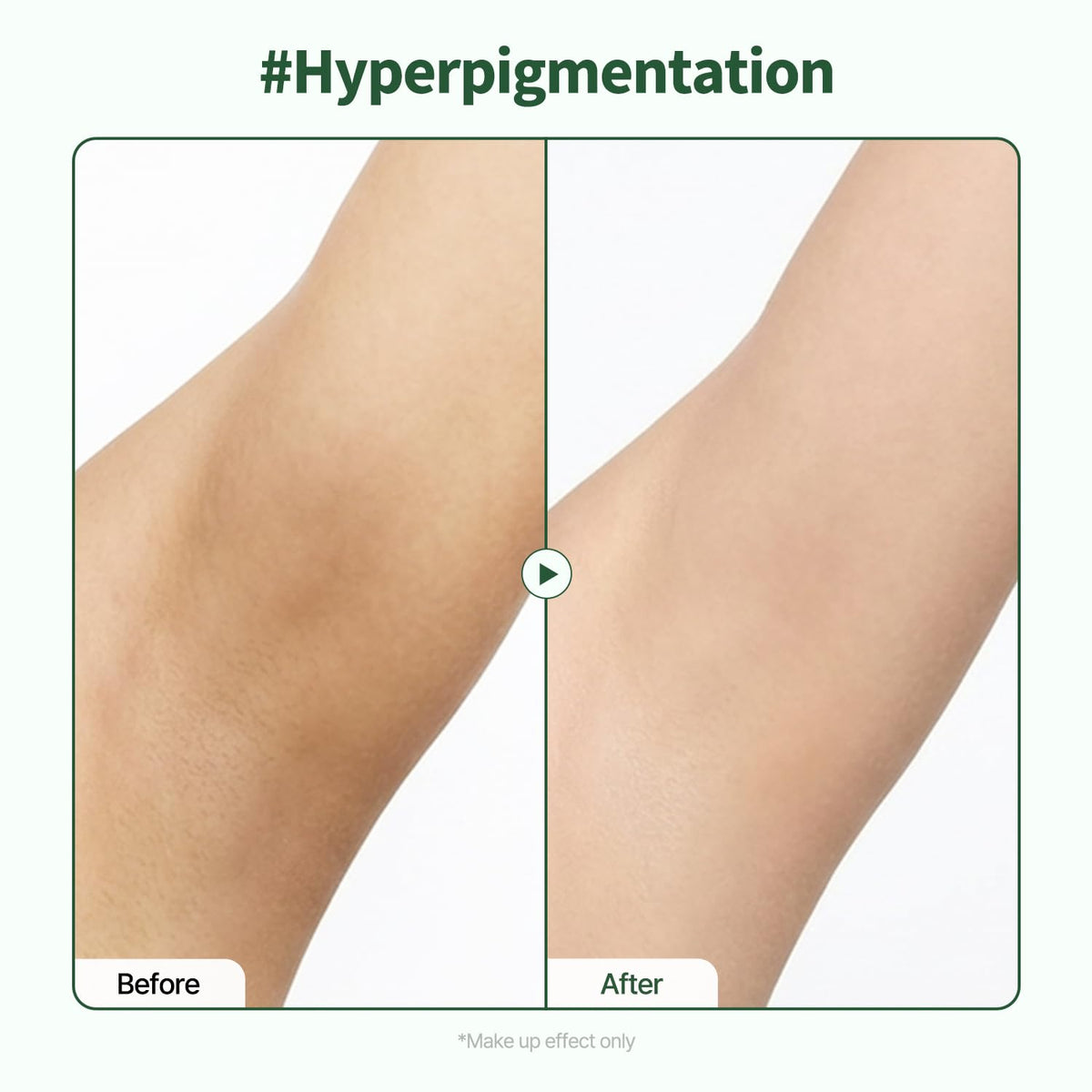 PONGDANG before and after comparison showing reduced uneven tone benefit