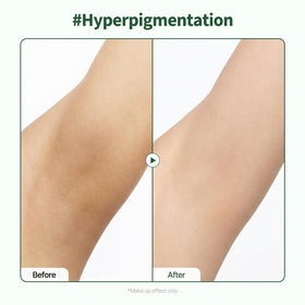 PONGDANG before and after comparison showing reduced uneven tone benefit