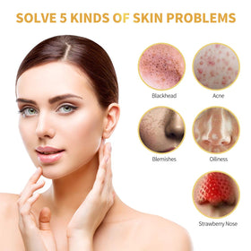 POP MODERN.C peeled mask being removed to reveal clearer looking skin