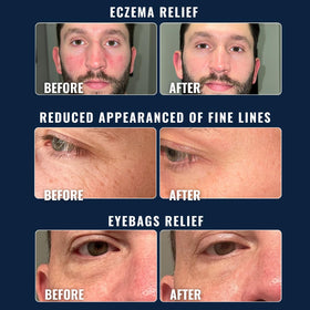 PrettyBoy applied to male model face showing soothing and non-greasy finish