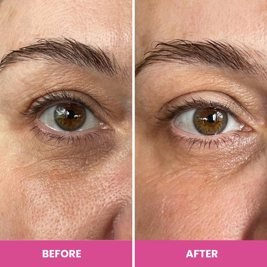 PRIME PROMETICS PrimeEyes ingredient layout highlighting peptides and hyaluronic