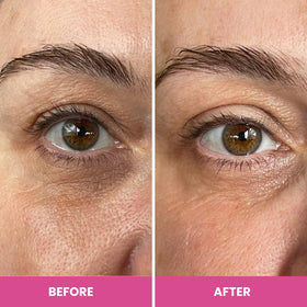 PRIME PROMETICS PrimeEyes ingredient layout highlighting peptides and hyaluronic