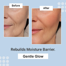 Prime Prometics used on neck and hands to show versatile hydrating benefits
