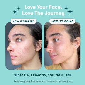 Proactiv Renewing Cleanser close-up pump and foam demonstrating gentle pore-clearing action