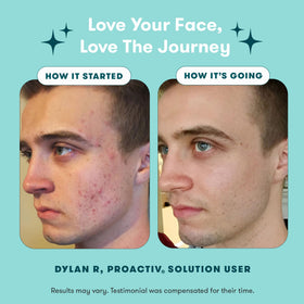 Proactiv repairing treatment applicator demonstrating targeted spot care