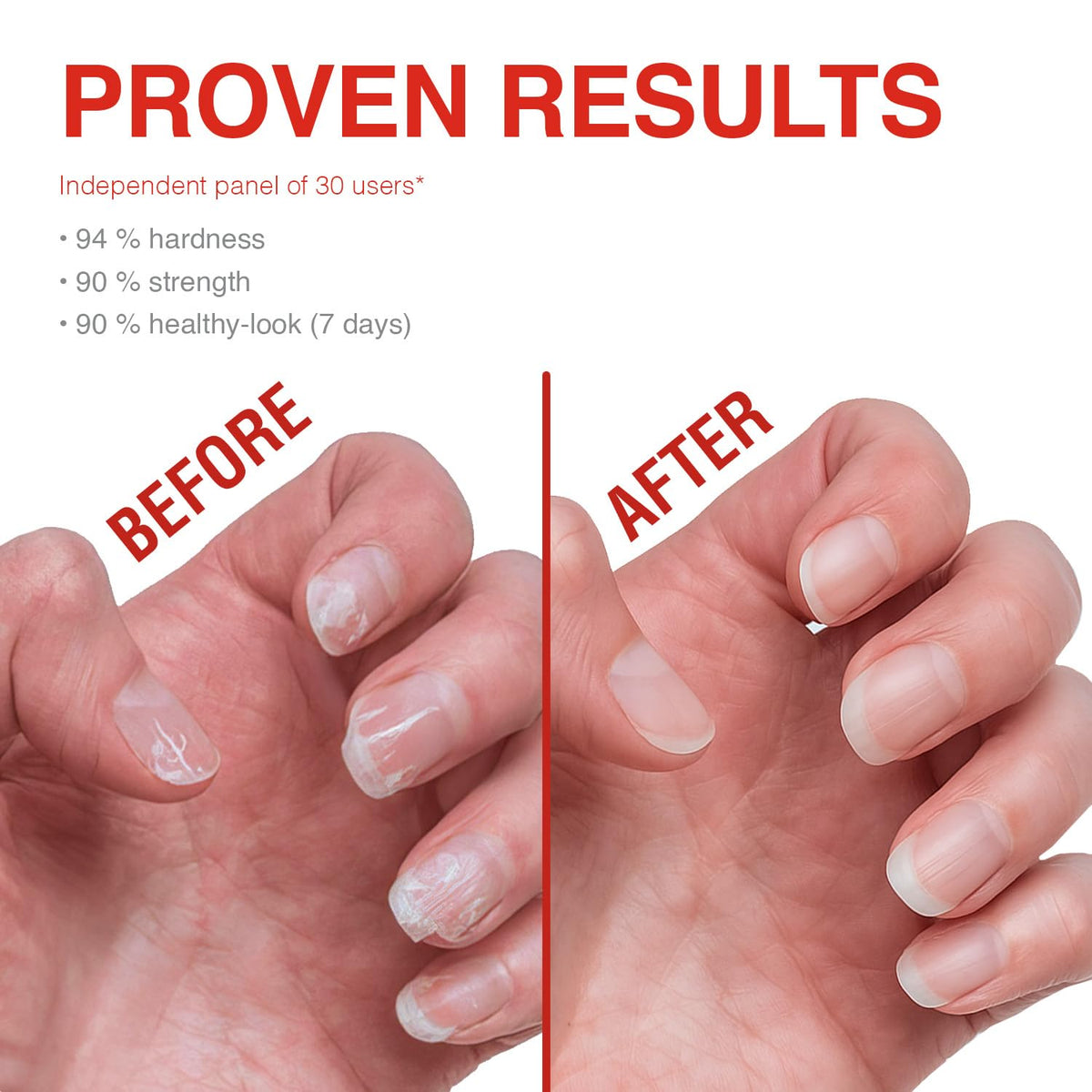 Probelle close-up of nail plate texture showing smoother surface benefit