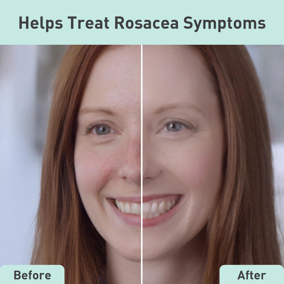 PROcure serum texture on fingertip showing lightweight absorbent gel benefit