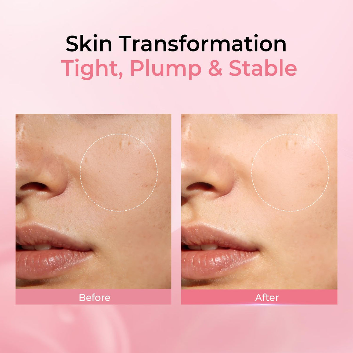 PROF.LING sheet conforming to facial contours for even absorption