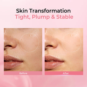 PROF.LING sheet conforming to facial contours for even absorption