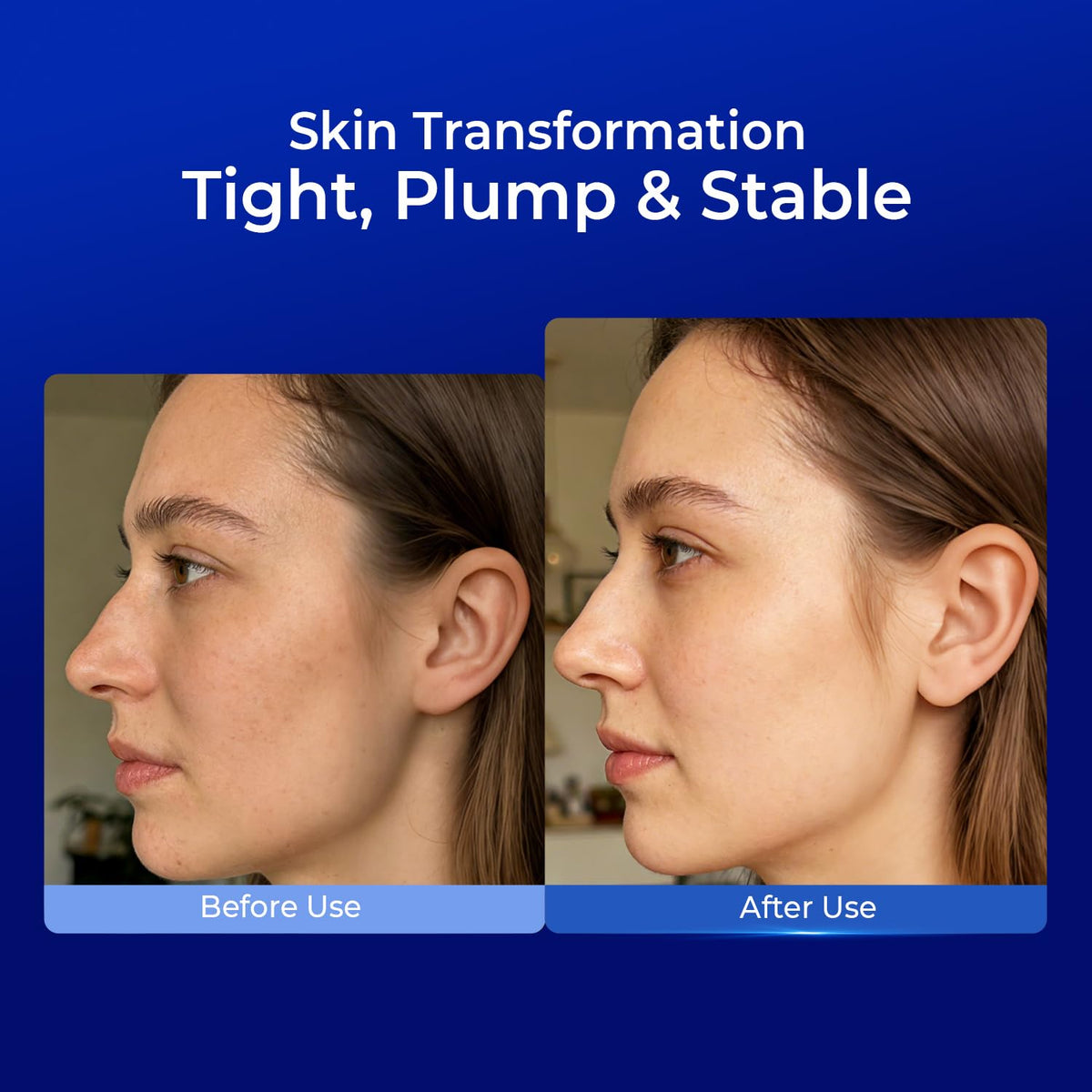 PROFLING applying serum after microneedling demonstrating soothing support