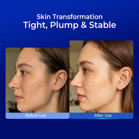 PROFLING applying serum after microneedling demonstrating soothing support