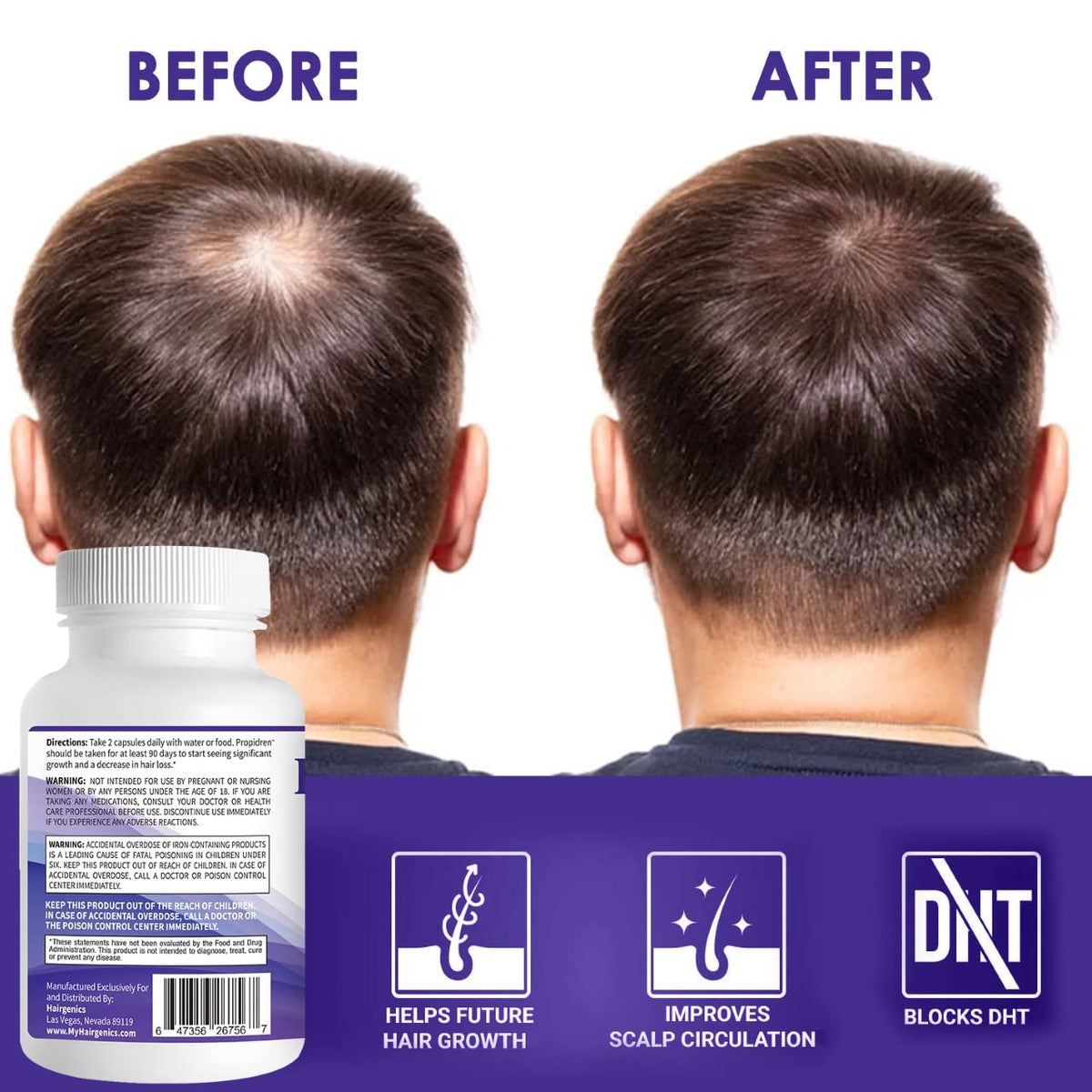Pronexa Propidren paired with hair loss shampoo in a bathroom setting for a complete care routine
