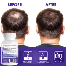Pronexa Propidren paired with hair loss shampoo in a bathroom setting for a complete care routine
