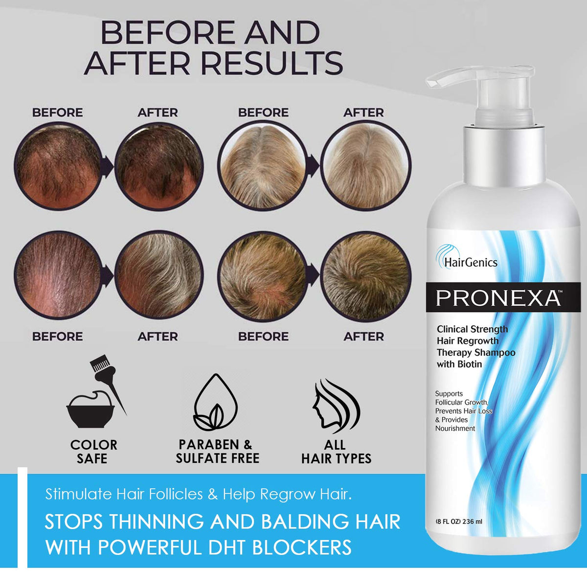 Pronexa Hairgenics 8 fl oz bottle next to everyday items showing compact travel-friendly size