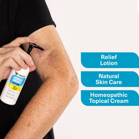 Pure Relief being applied to arm demonstrating targeted bruise and swelling support