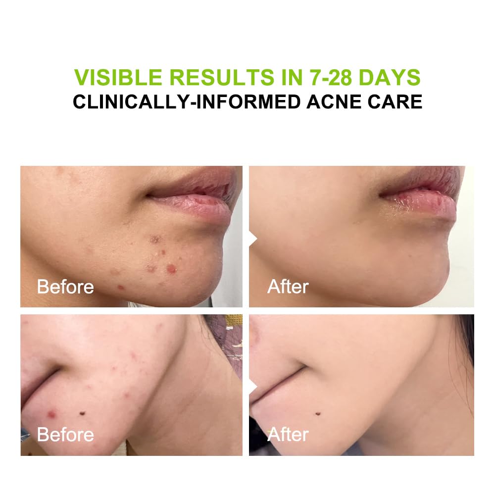 pure.tiful label ingredient list view showing 2% salicylic acid benefit