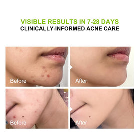 pure.tiful label ingredient list view showing 2% salicylic acid benefit