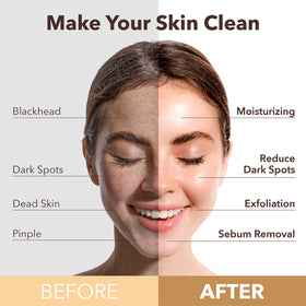 Purederm image of oxygenating foam texture lifting away impurities