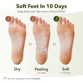 Purederm sock design close-up showing comfortable seal and fit