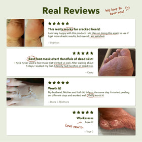 purederm travel ready socks packed in toiletry bag for convenience on trips and events