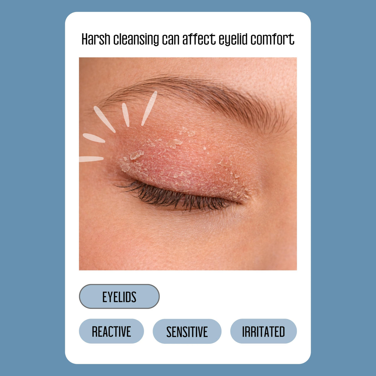 PURELID wipe in hand for fast no‑rinse cleansing convenience