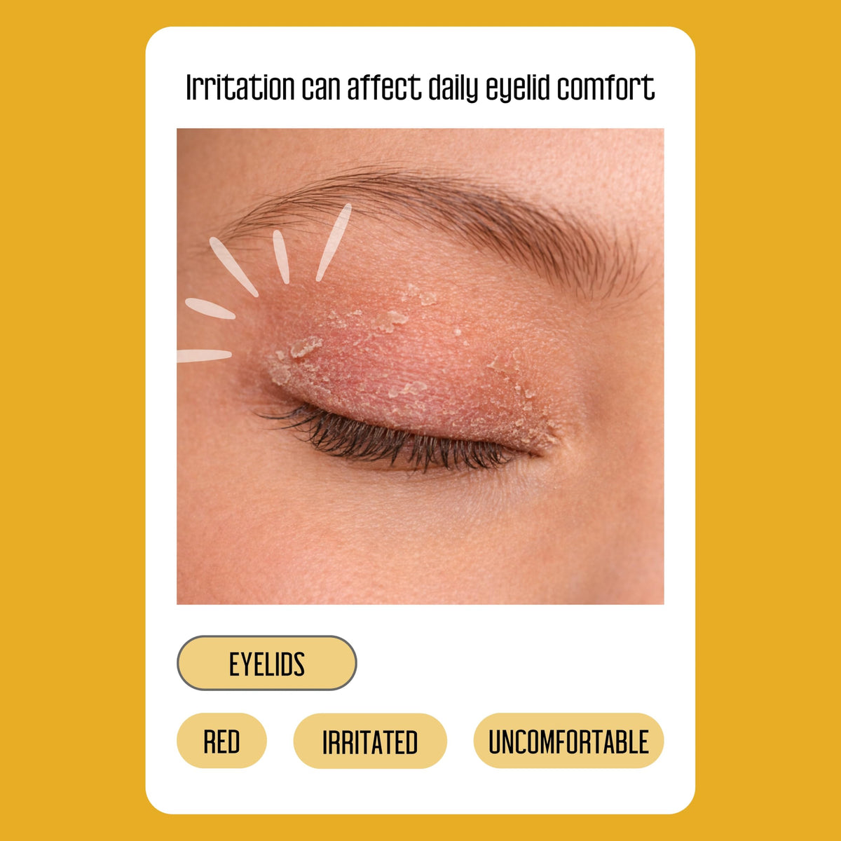 PURELID wipe in hand demonstrating size and coverage benefit