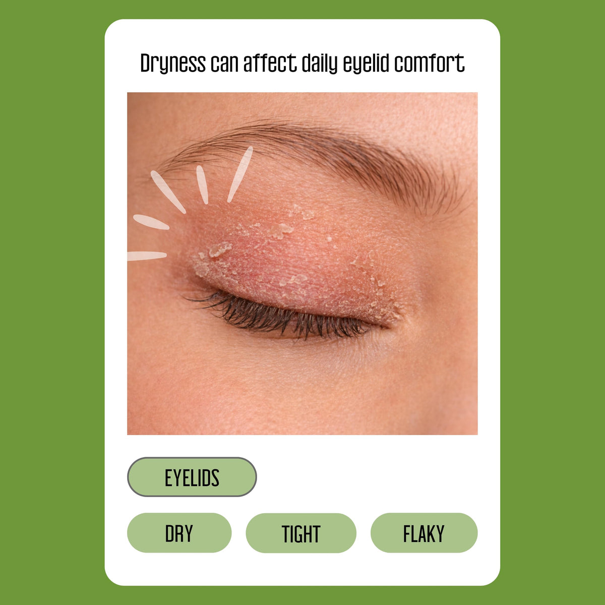 PURELID wipe saturated with solution highlighting nourishing formula