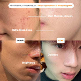 Purify Puréel serum texture on hand illustrating fast absorbency and non-greasy feel