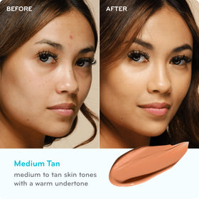 pūrlisse before and after on cheek showing reduced redness and smoother tone