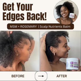 Qhemet Biologics jar in hand showing 4 oz size for easy at-home treatments
