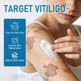 Qpywd being applied on hand illustrating targeted spot coverage benefit