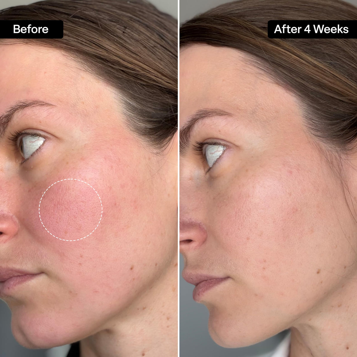 QRxLabs squalane oil texture close-up highlighting lightweight, non-greasy finish